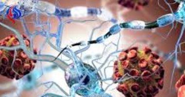 هارفارد تحذر من نقص فيتامين (د) أثناء الحمل لتسببه فى هذا المرض