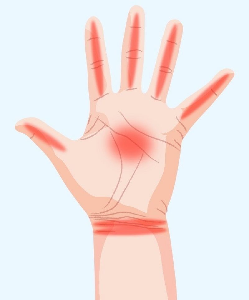 اسرار الصحة التي يكشفها تنميل هذه المناطق في اليدين