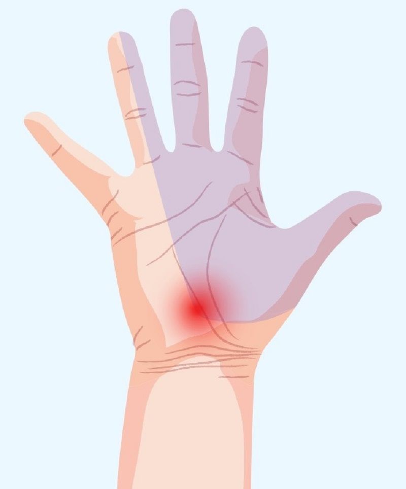 اسرار الصحة التي يكشفها تنميل هذه المناطق في اليدين