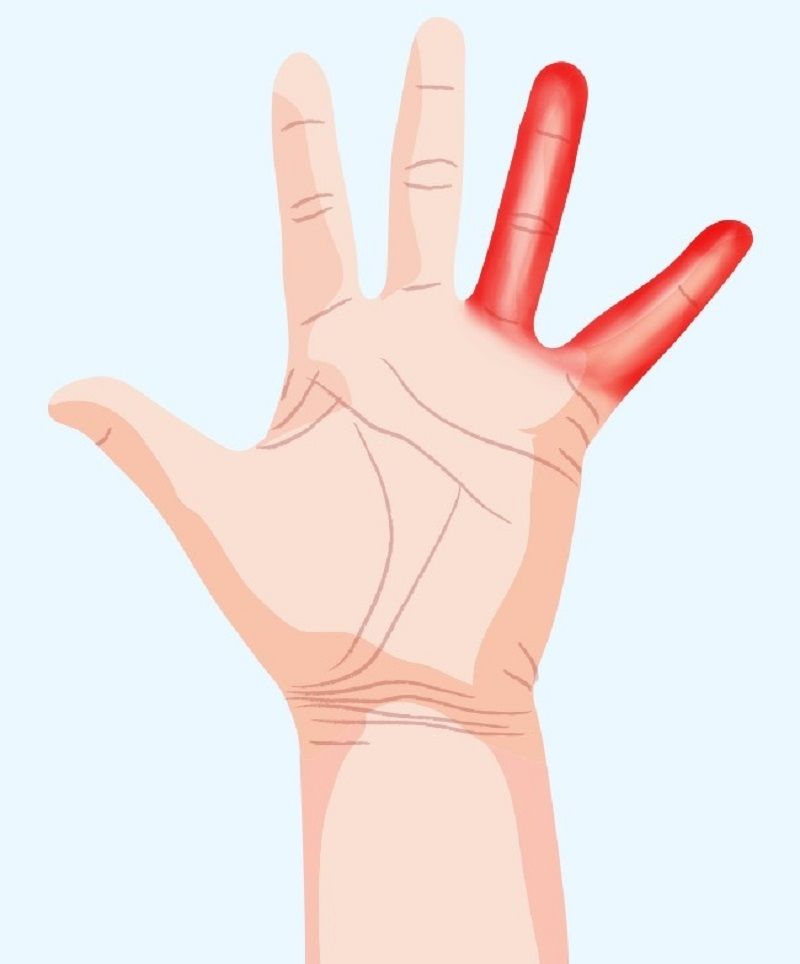 اسرار الصحة التي يكشفها تنميل هذه المناطق في اليدين