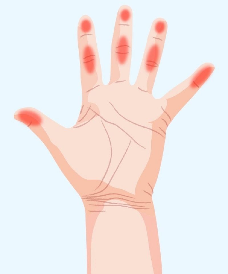 اسرار الصحة التي يكشفها تنميل هذه المناطق في اليدين