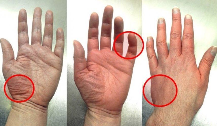 تعرف على طرق قياس ضغط الدم في المنزل