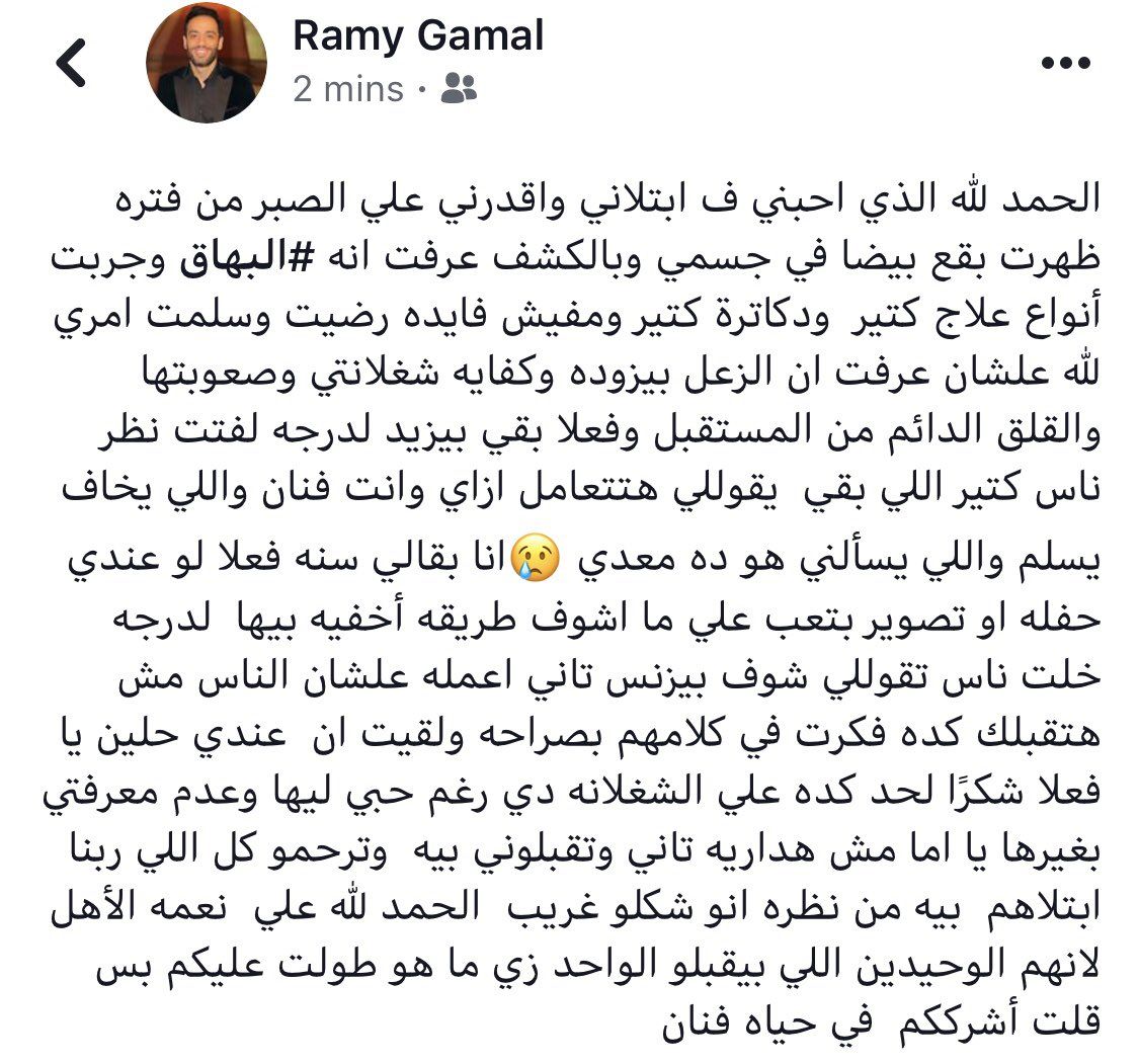 رامى جمال يعلن إصابته بمرض البهاق ويفكر فى الاعتزال