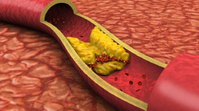 الكشف عن 5 فواكه شتوية تفتت الكوليسترول في الدم