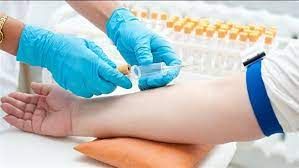 هل تواجه صعوبة في سحب الدم بسبب اختفاء العروق؟ اتبع هذه النصائح