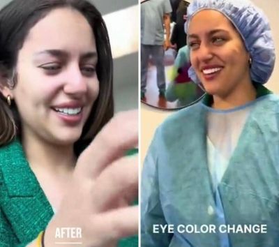 تراند اليوم : فتاة تجري عملية جراحية لتغيير لون عينيها للأبد.. شاهد: ردة فعلها بعد انتهاء العملية!