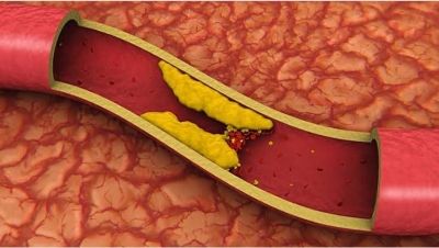 تراند اليوم : الكشف عن خضروات شائعة تخفض الكوليسترول والدهون الثلاثية وتحمي القلب
