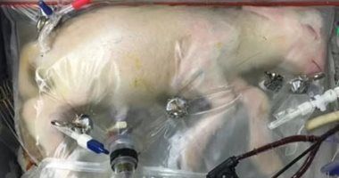 تكنولوجيا: رحم اصطناعى للأطفال المبتسرين سيكون متاحا هذا العام.. تفاصيل التقنية