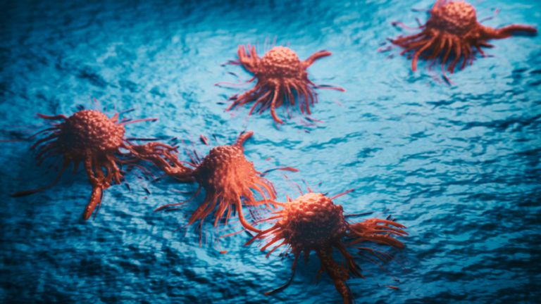 "علامة مبكرة مقلقة".. كراهية 4 أطعمة قد تشير للإصابة بالسرطان!