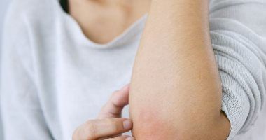 طرق الوقاية من التهاب الجلد مع انخفاض درجات الحرارة