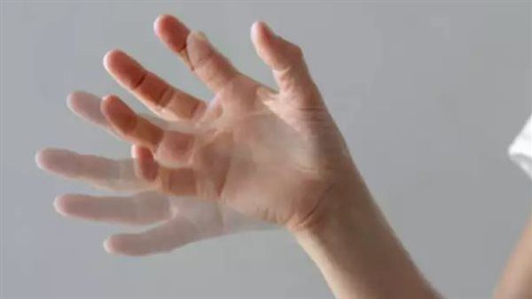 أعراض نقص الكالسيوم في الجسم| تعرف عليها