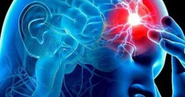 وزارة الصحة تكشف نصائح مهمة للوقاية من السكتة الدماغية​