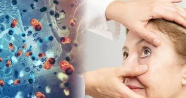 متلازمة كورونا طويلة المدى توثر بصورة أكبر على أصحاب التاريخ المرضى