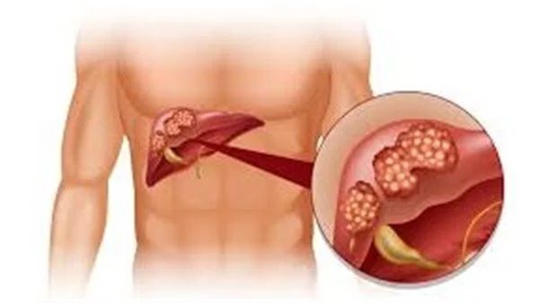 5 مشروبات الكثير من الناس لا يعلمون أنها خطيرة تضرب الأنسولين وترفع نسبة السكر في الدم.