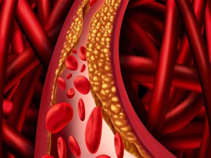مشروب بـ10 جنيهات يحمي القلب.. لن تصدق تأثيره على مستوى الكوليسترول