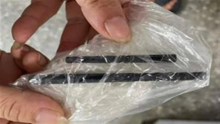 رجل يعاني من الصداع لمدة 5 أشهر.. السبب مفاجأة غير متوقعة