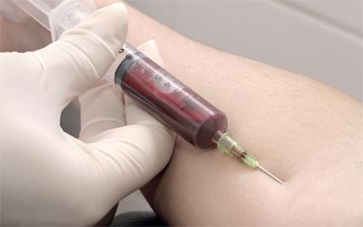 الامارات | اختبار دم «ثوري» قد يكشف عن أورام المخ