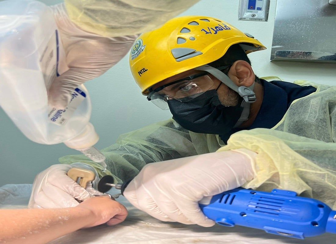 "مدني الرياض" يحرّر إصبع شخص من قطعة معدنية