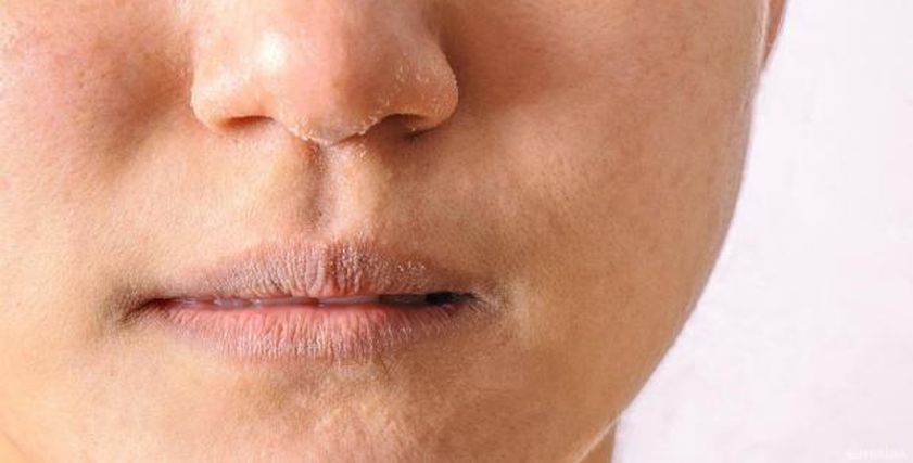 7 نصائج لترطيب البشرة ومنع جفافها في الشتاء.. ما علاقة النوم؟