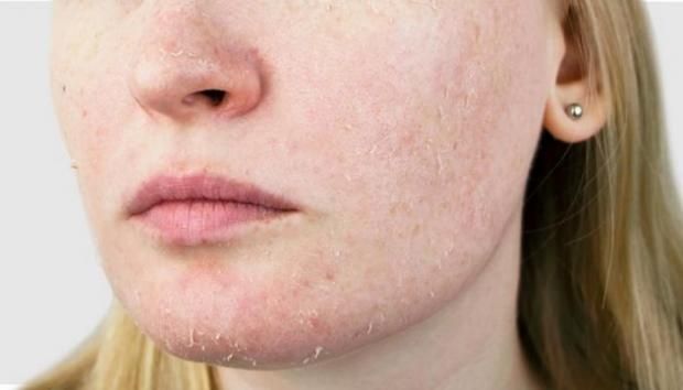 7 نصائج لترطيب البشرة ومنع جفافها في الشتاء.. ما علاقة النوم؟