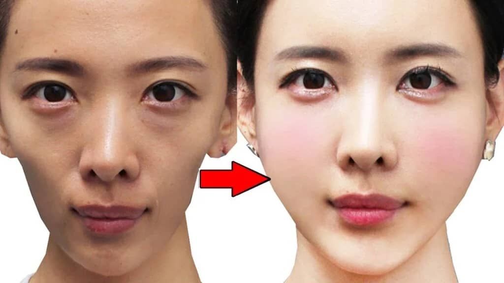 استخدام الخميرة لنفخ الخدود والحصول على بشرة نضرة وخالية من أي تجاعيد