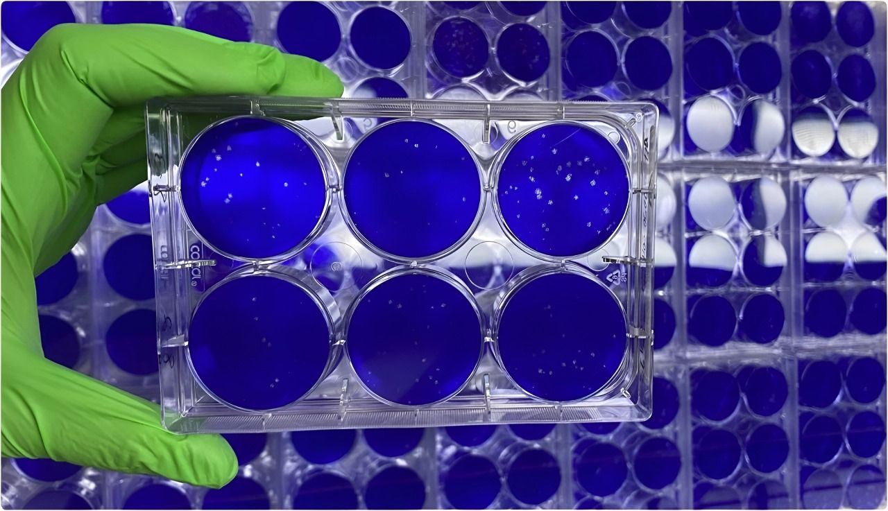 بكتيريا “قاتلة” تظهر في “الصين”