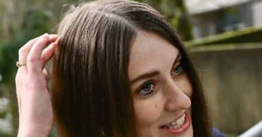 إنجاز طبى جديد.. نجاح عملية زرع دماغ لأمريكية لعلاج الوسواس القهري والصرع