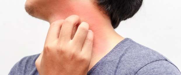 طريقة التخلص من حكة الجسم.. وصفات منزلية تقضي على الألم