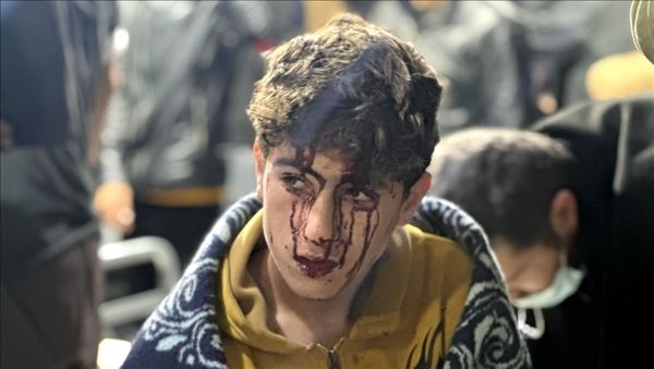 أطفال بغزة.. خرجوا لجمع الحطب فأشعل الاحتلال إسرائيلي أجسادهم