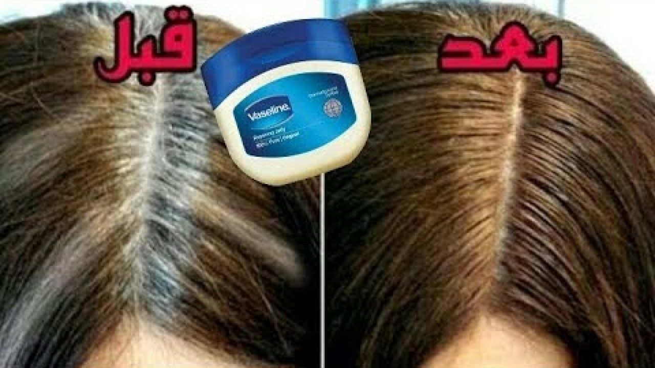 وصفة الفازلين للقضاء على الشعر الأبيض نهائيا بدون رجوعه مرة أخرى بدون صبغات ضارة أو اكسجين