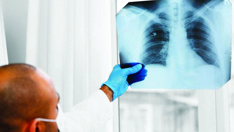 الامارات | الوذمة الرئوية.. تلقي الرعاية يحمي من المضاعفات الخطرة