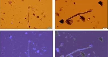 تكنولوجيا: العثور على جزيئات بلاستيكية سامة فى المشيمة البشرية