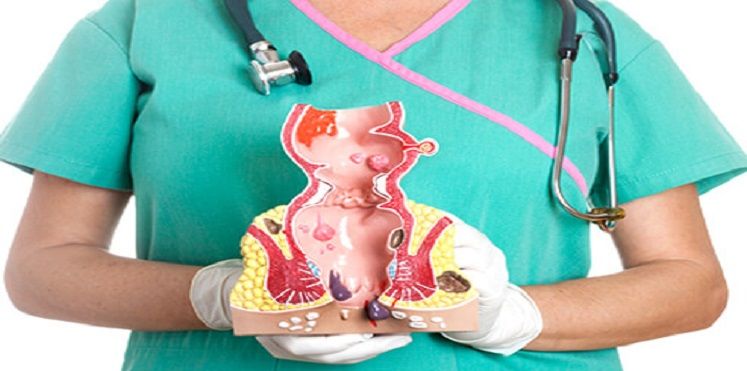 لن تندم العلاج بين يديك .. للقضاء على البواسير بشكل نهائي وانت في منزلك بطريقة بسيطة جدا!