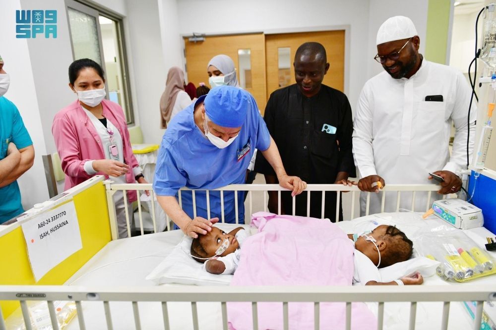 بتوجيهات القيادة الرشيدة.. بدء عملية فصل التوأم السيامي النيجيري "حسنة وحسينة" اليوم