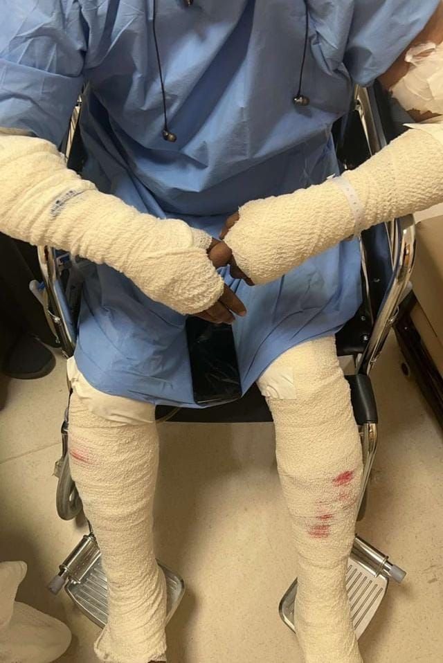 مواطن يروي تفاصيل نجاته من الموت بعد هجوم الكلاب الضالة عليه في تبوك .. فيديو