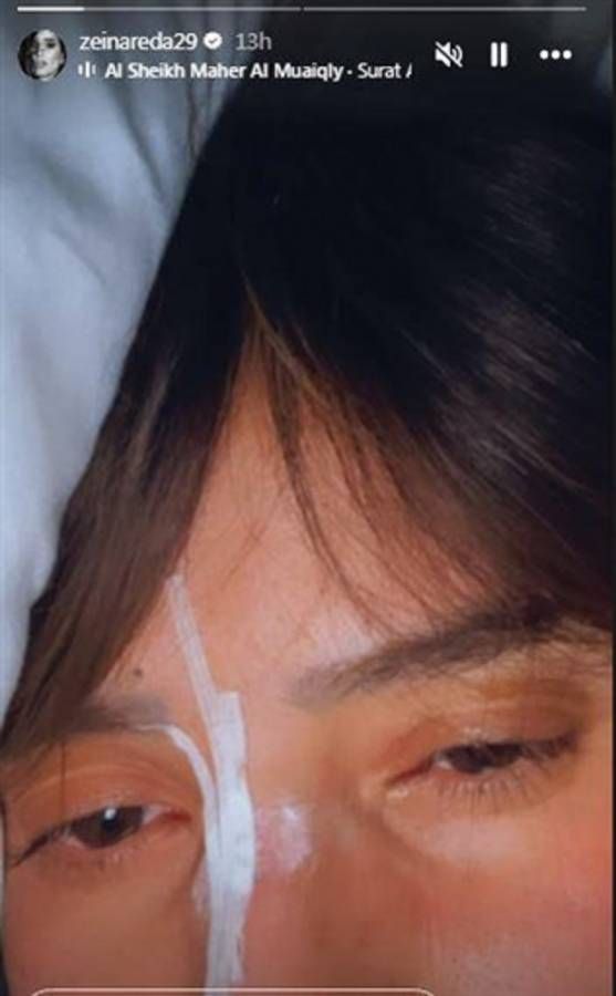 زينة تتعرض لإصابة في وجهها.. صورة تقلق محبيها