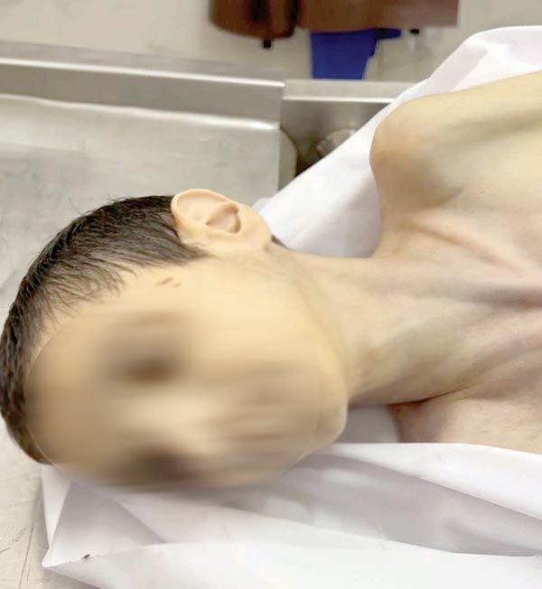 «نتنياهو» يواصل المحارق فى قطاع غزة للشهر السادس
