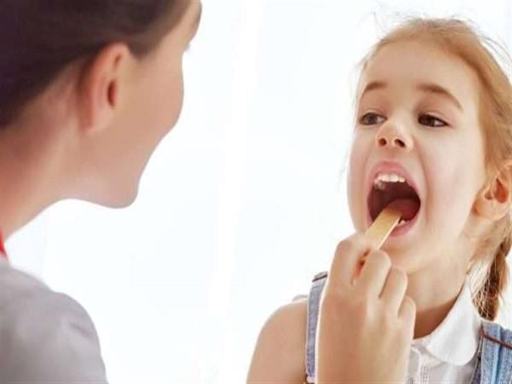 أسباب لن تتوقعها للتهاب سقف الحلق المفاجئ.. وهكذا تتعامل معه