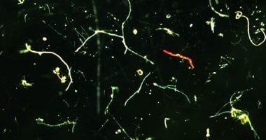 تكنولوجيا: دراسة: المواد البلاستيكية الدقيقة تزيد من خطر الإصابة بنوبة قلبية