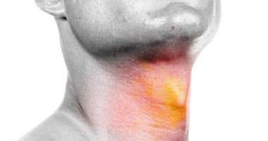 4 أخطاء ترتكبها تسبب التهاب الحنجرة