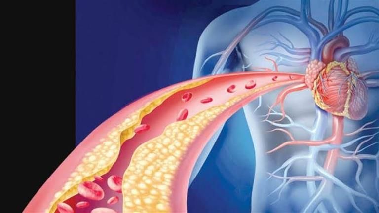 أفضل 5 مصادر دهون لخفض الكولسترول الضار
