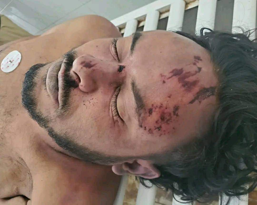 بدت على وجهه جروح ودماء.. وفاة أحد نزلاء السجن المركزي بإب في ظروف غامضة