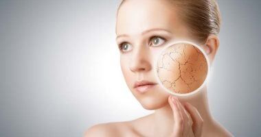 أسباب أخرى لجفاف الجلد رغم تناول كميات وفيرة من الماء.. اعرفها