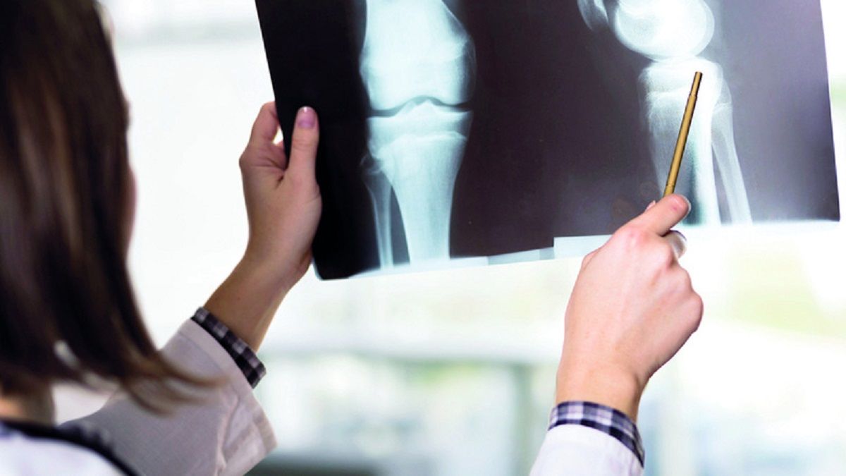 الامارات | انتبهوا إلى نقص فيتامين د والكالسيوم.. عوامل ترفع خطر الإصابة بهشاشة العظام