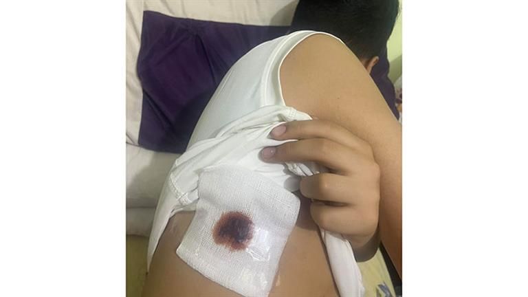 طالب يعتدي على زميله بسلاح أبيض أمام المدرسة في الغربية