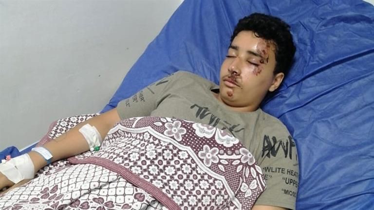 "بتروش مع صديقاتها".. طالبة تدهس زميلها بسيارة والدتها أمام المدرسة في الشرقية (صور)