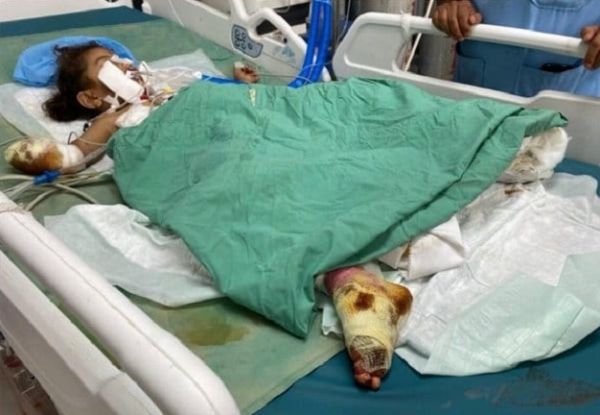 مرصد حقوقي: مقتل وإصابة 13 مدنياً جراء الألغام الحوثية ومخلفات الحرب منذ مطلع مايو الجاري