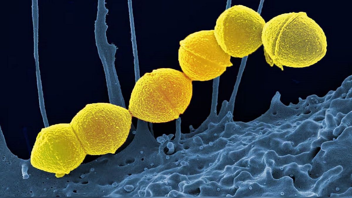 الامارات | عدوى فتاكة تنتشر بوتيرة قياسية في اليابان.. ما أعراض متلازمة الصدمة السامة العقدية؟