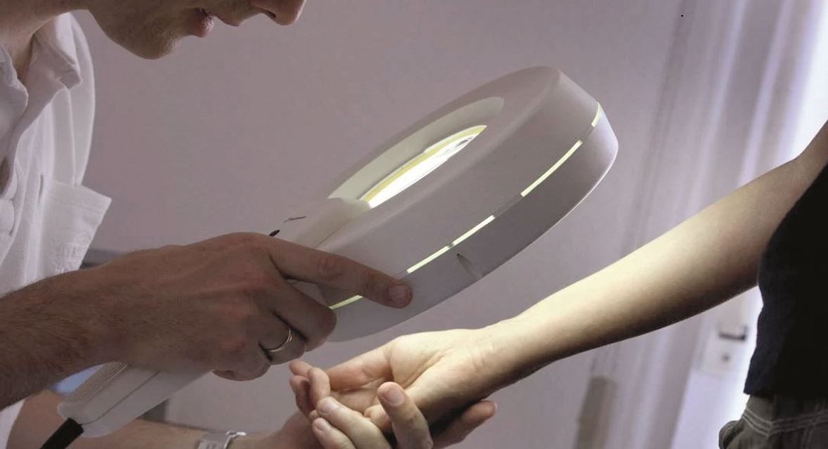 الامارات | أطباء: انتبهوا إلى هذه التغيرات الطارئة على الشامة.. قد تنذر بالخطر