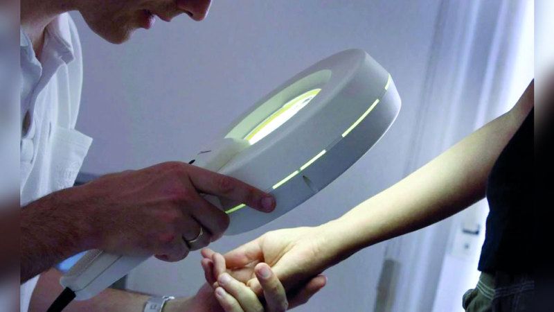 الامارات | التغيرات الطارئة على الشامة.. ناقوس خطر